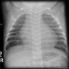 background presentation